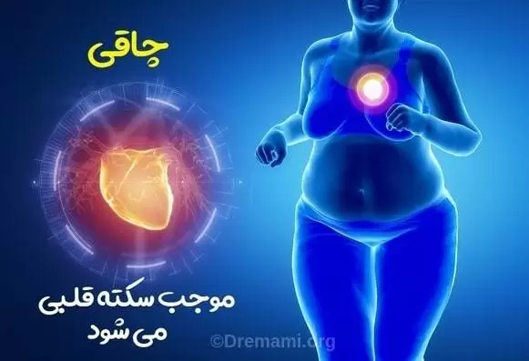 چاقی موجب سکته قلبی می شود
