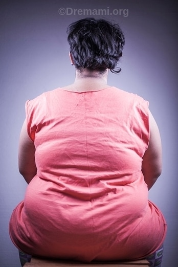 دلیل افزایش وزن در خانم ها