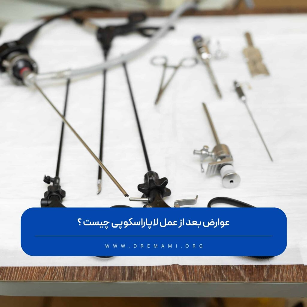 عوارض بعد از لاپاراسکوپی