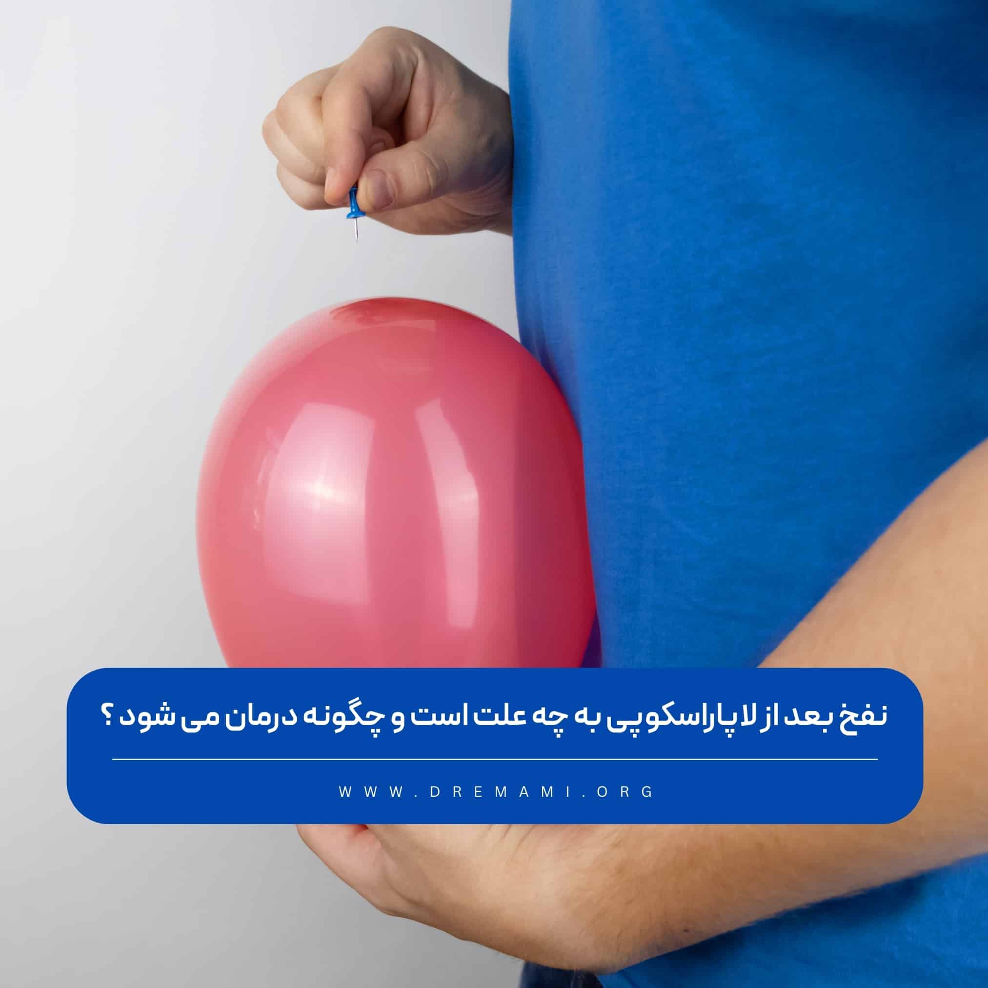 نفخ شکم بعد از لاپاراسکوپی