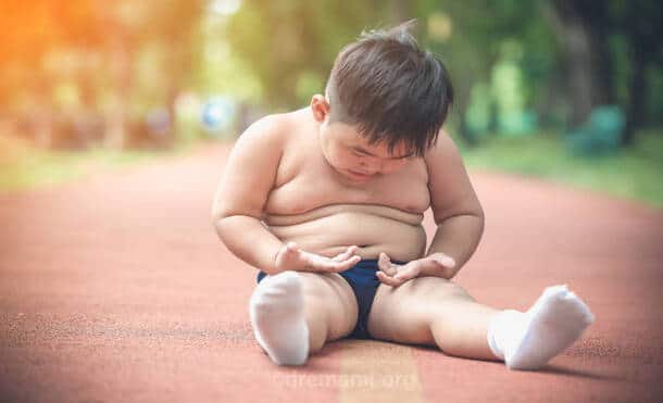 انواع مدل چاقی در کودکان