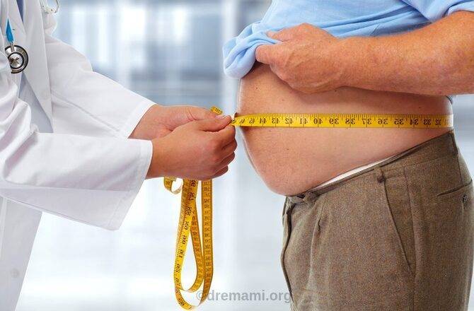 انواع مدل چاقی 