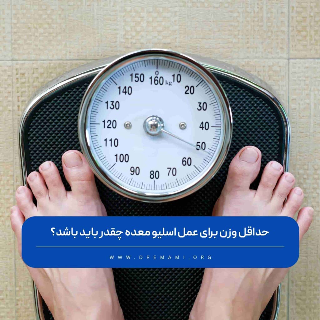 حداقل وزن برای اسلیو معده