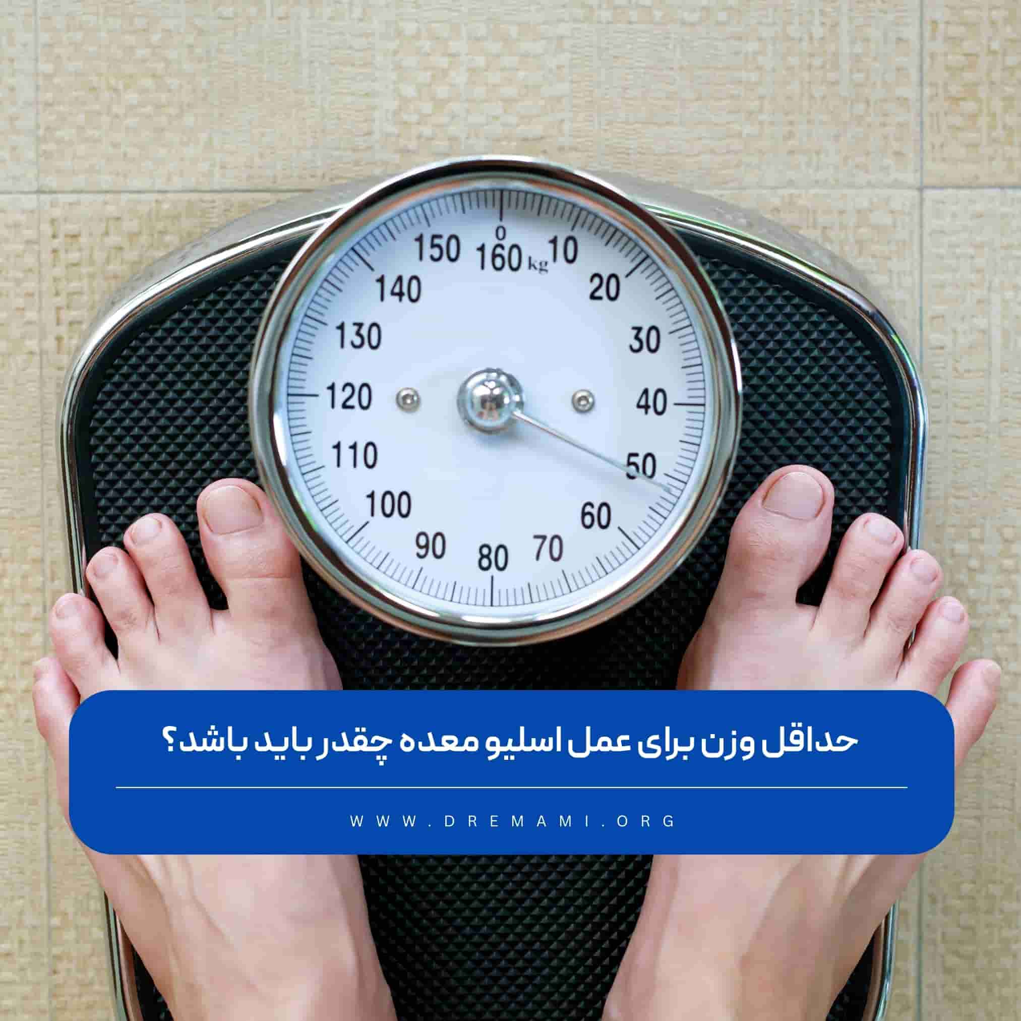 حداقل وزن برای اسلیو معده