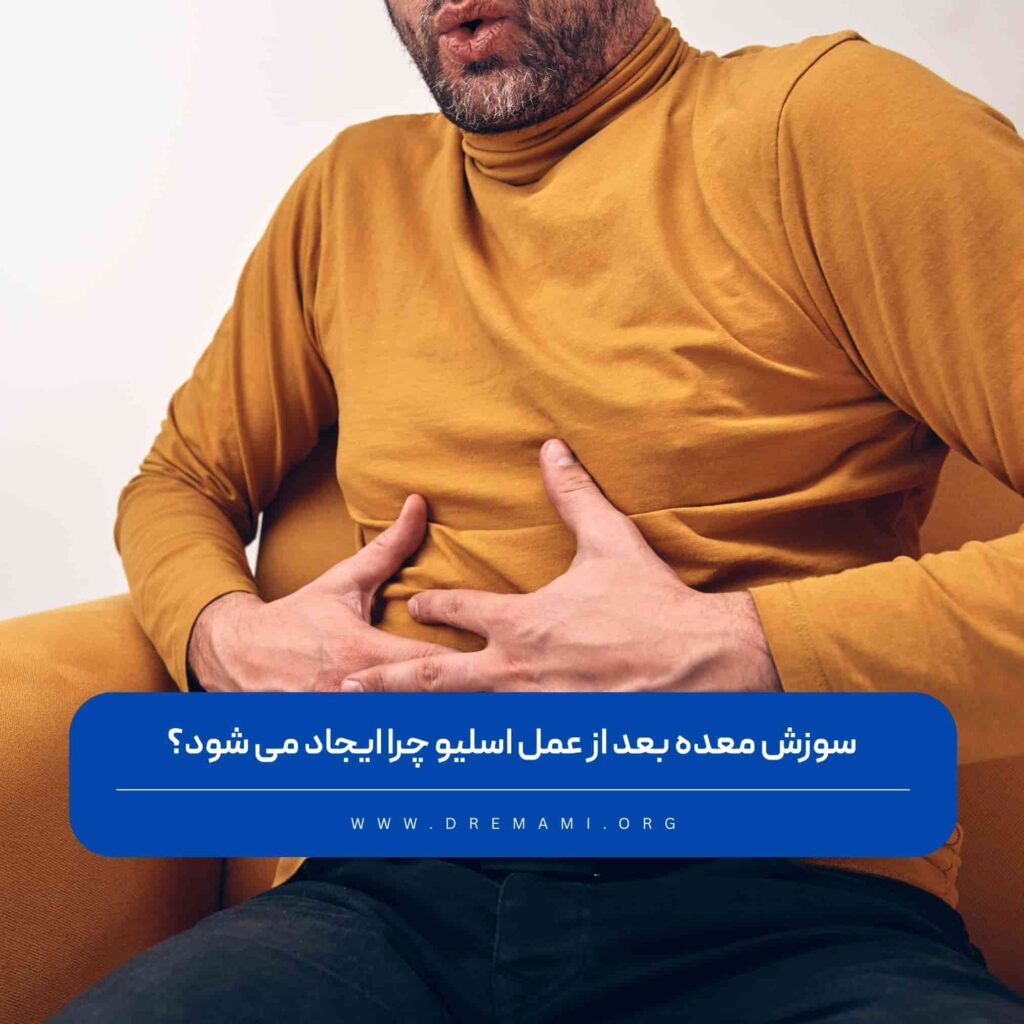 سوزش معده بعد از عمل اسلیو