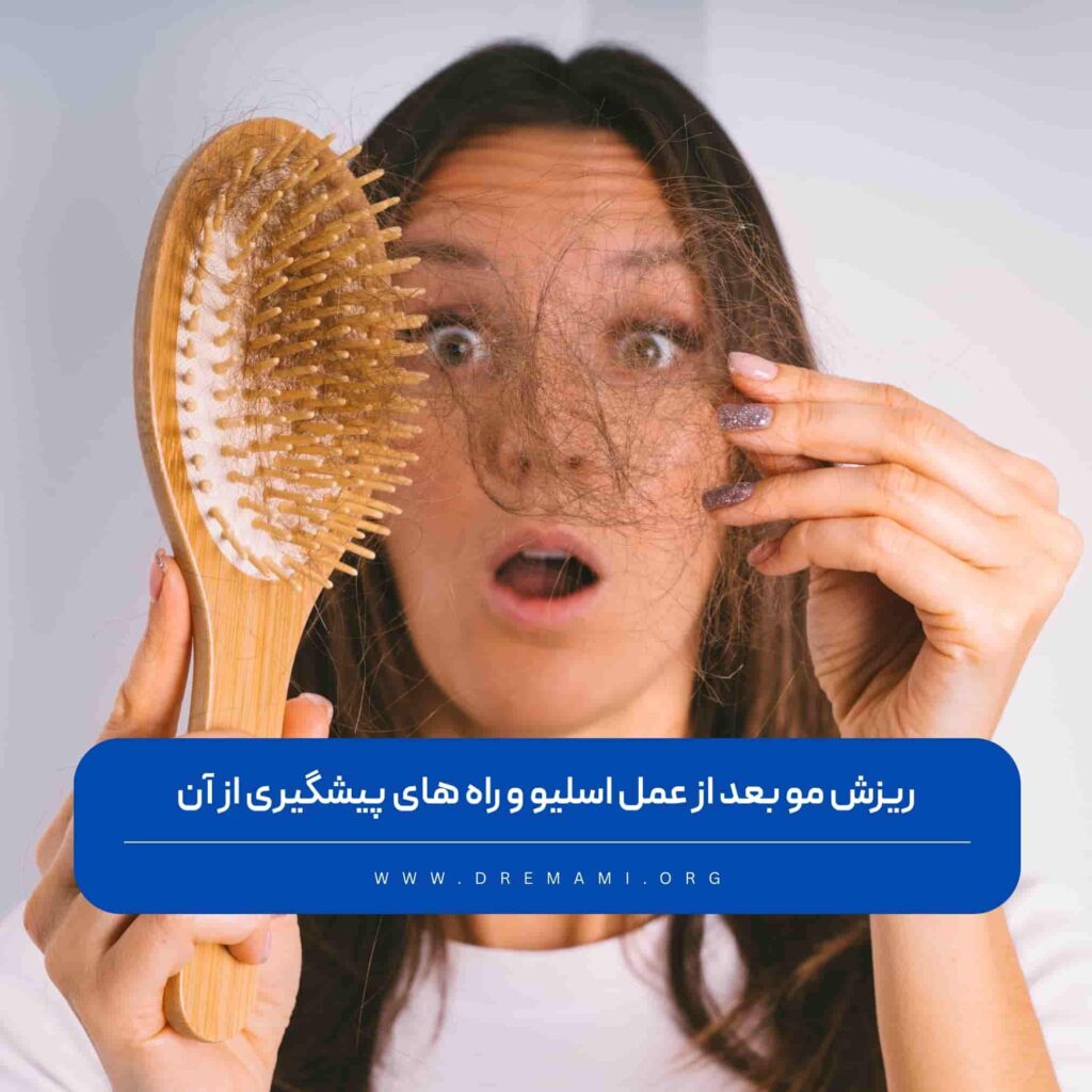 ریزش مو بعد از عمل اسلیو معده