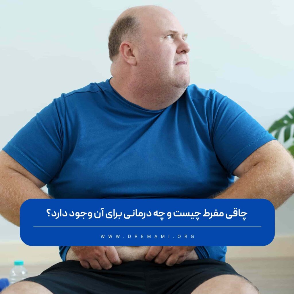 چاقی مفرط چیست ؟