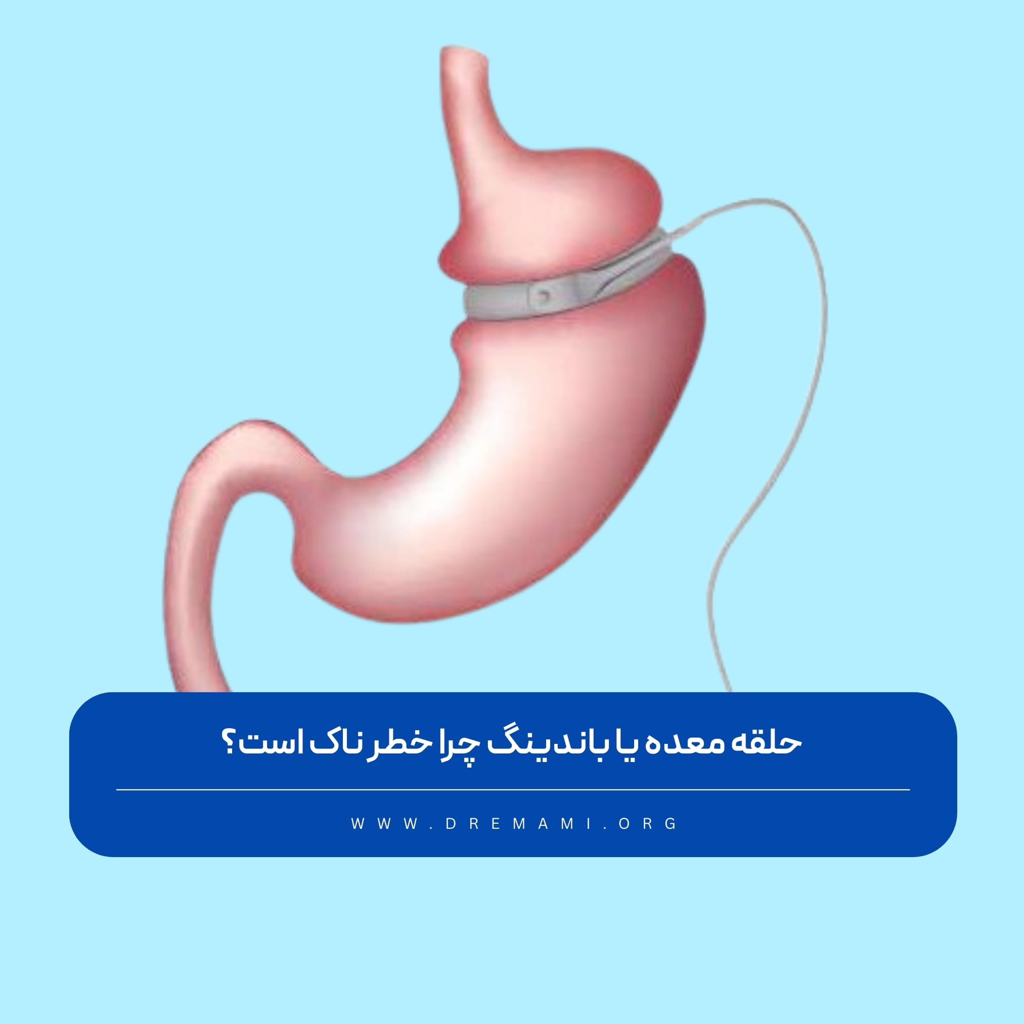 حلقه معده