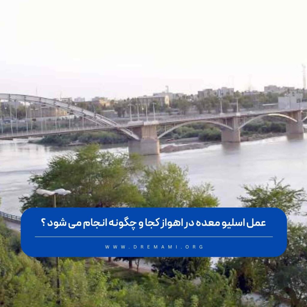 عمل اسلیو معده در اهواز