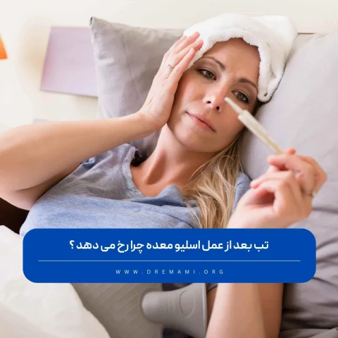 تب بعد از عمل اسلیو معده