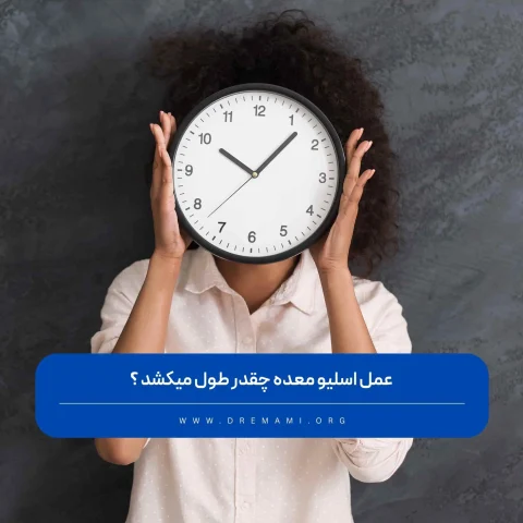 عمل اسلیو معده چقدر طول میکشد
