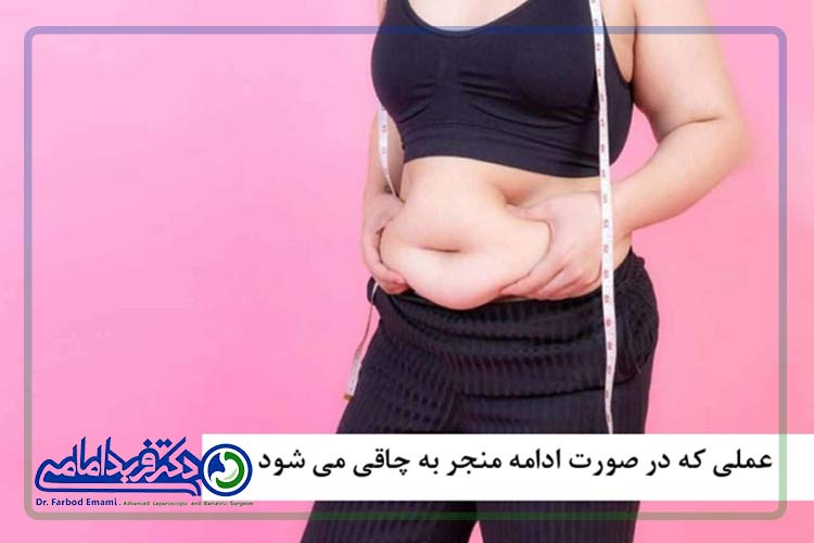 بازیابی مجدد وزن بعد از عمل اسلیو معده