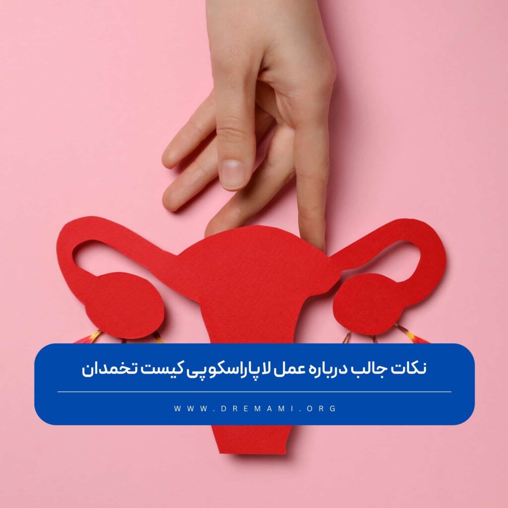 لاپاراسکوپی کیست تخمدان