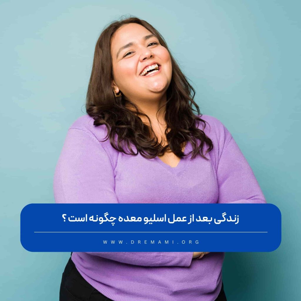 زندگی بعد از اسلیو معده