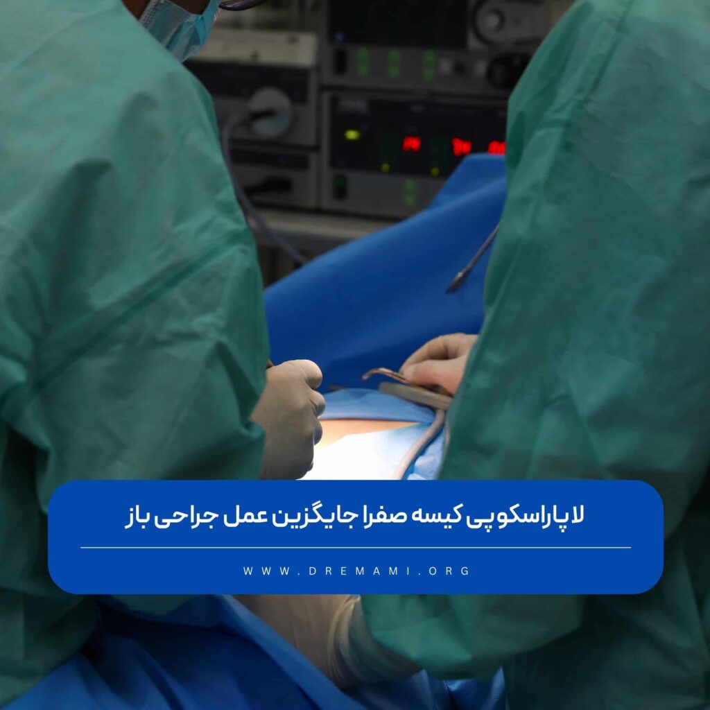 لاپاراسکوپی کیسه صفرا