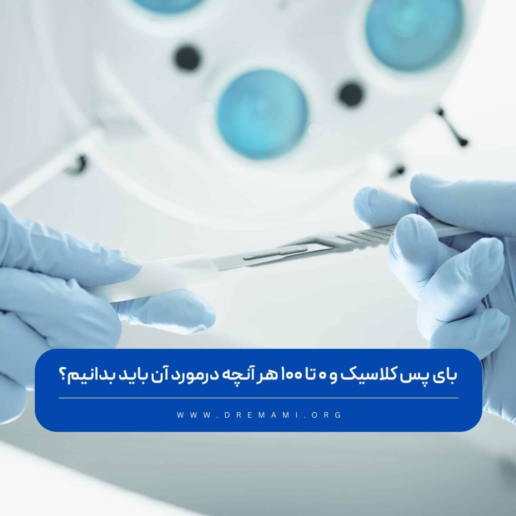 بای پس کلاسیک