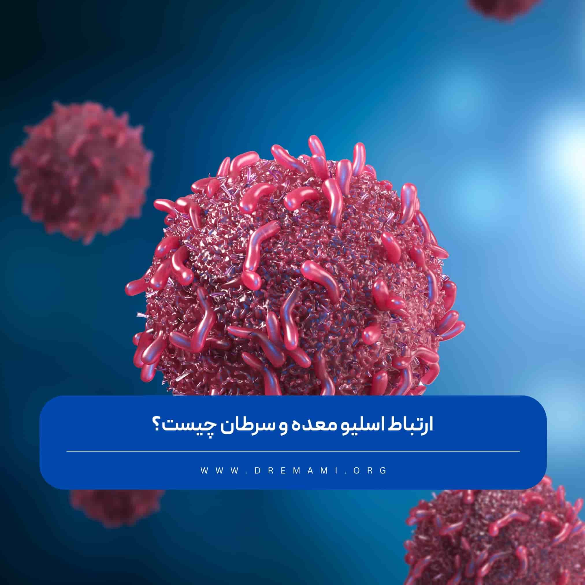 رابطه اسلیو معده و سرطان