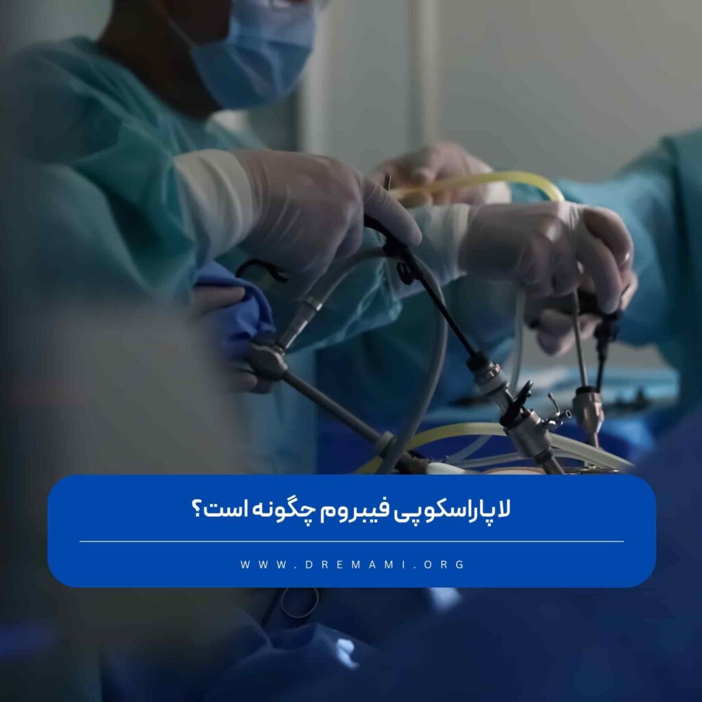 لاپاراسکوپی فیبروم رحم