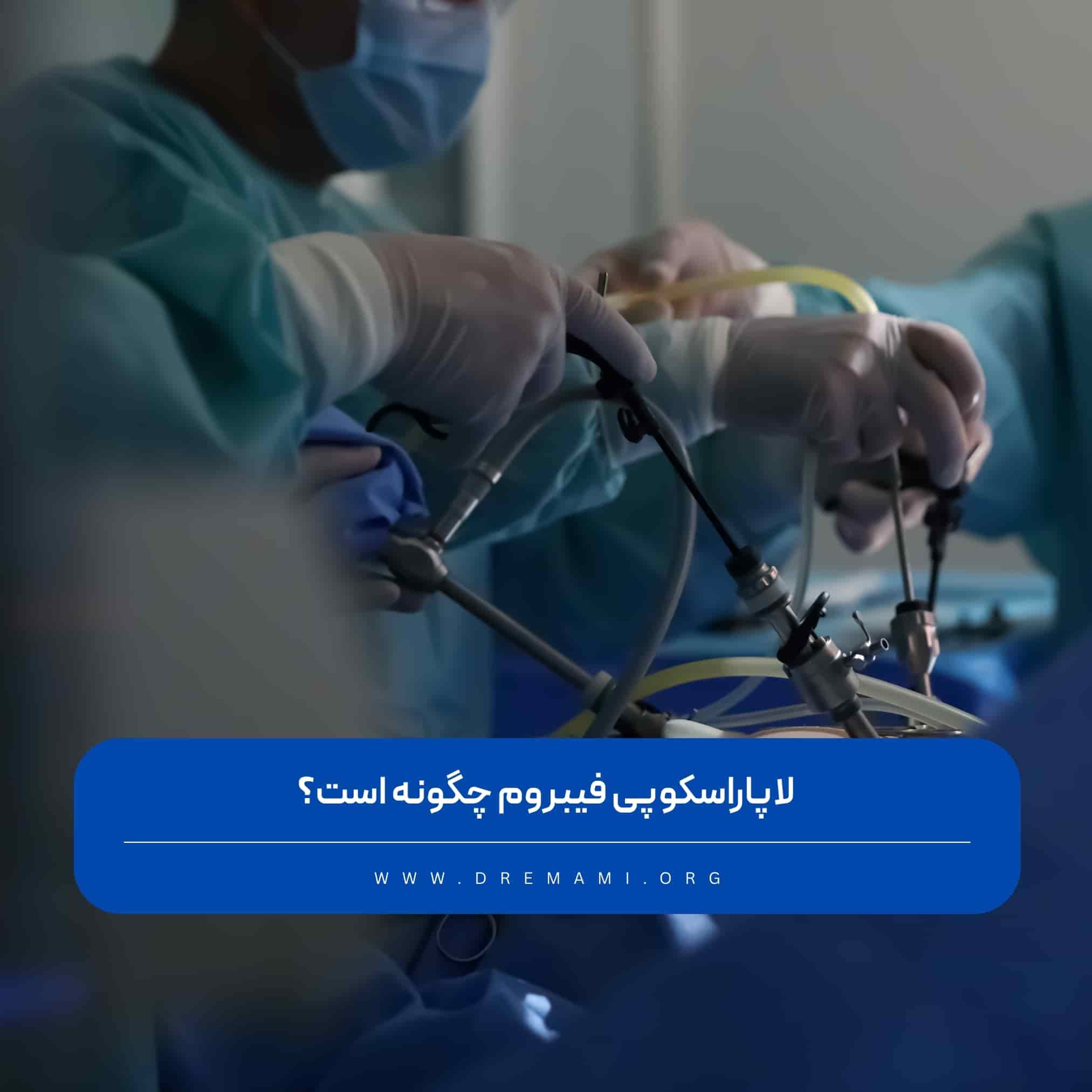 لاپاراسکوپی فیبروم رحم