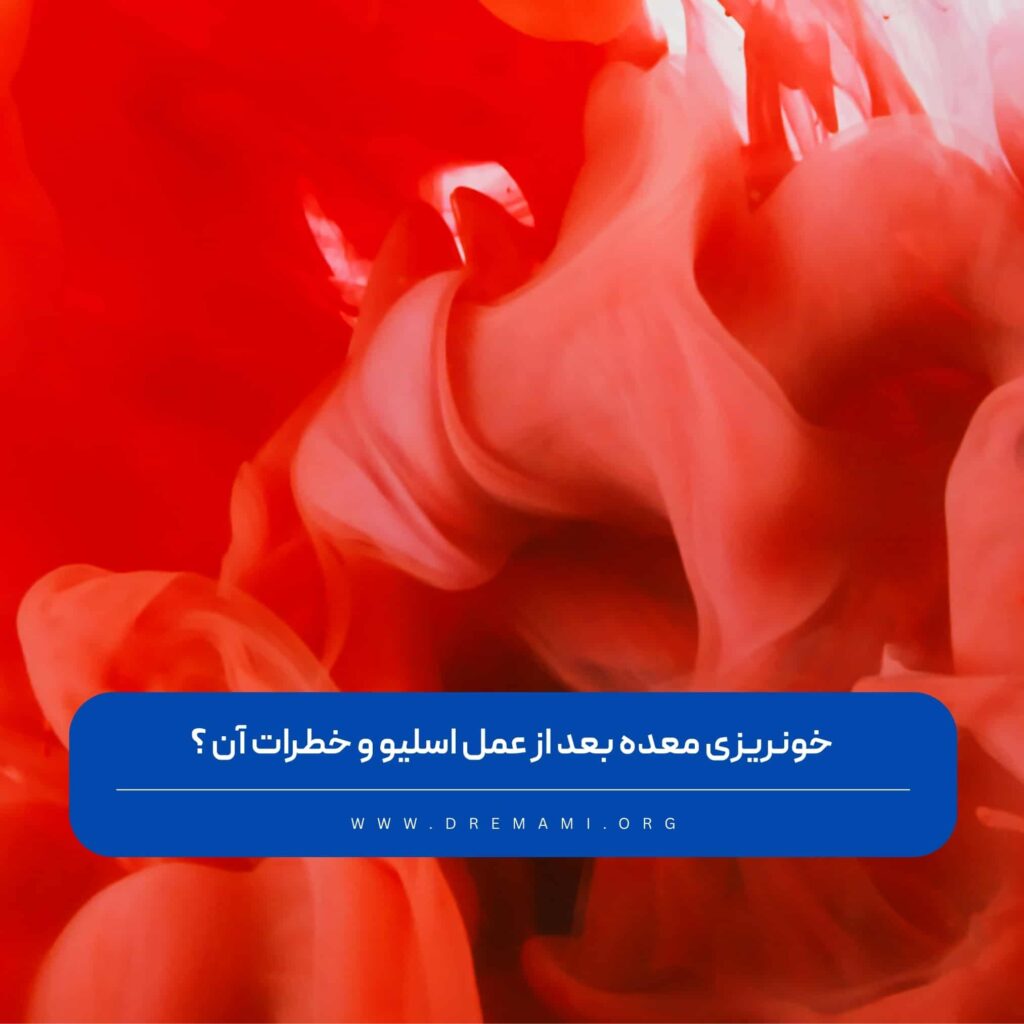 خونریزی بعد از اسلیو معده