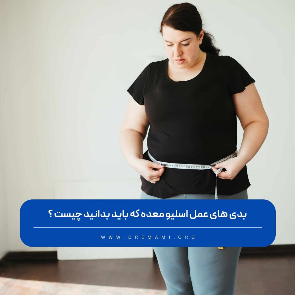 بدی های عمل اسلیو معده