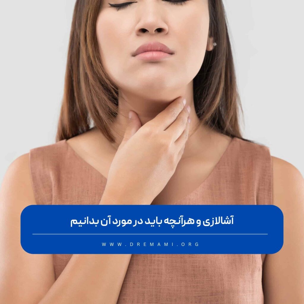 آشالازی