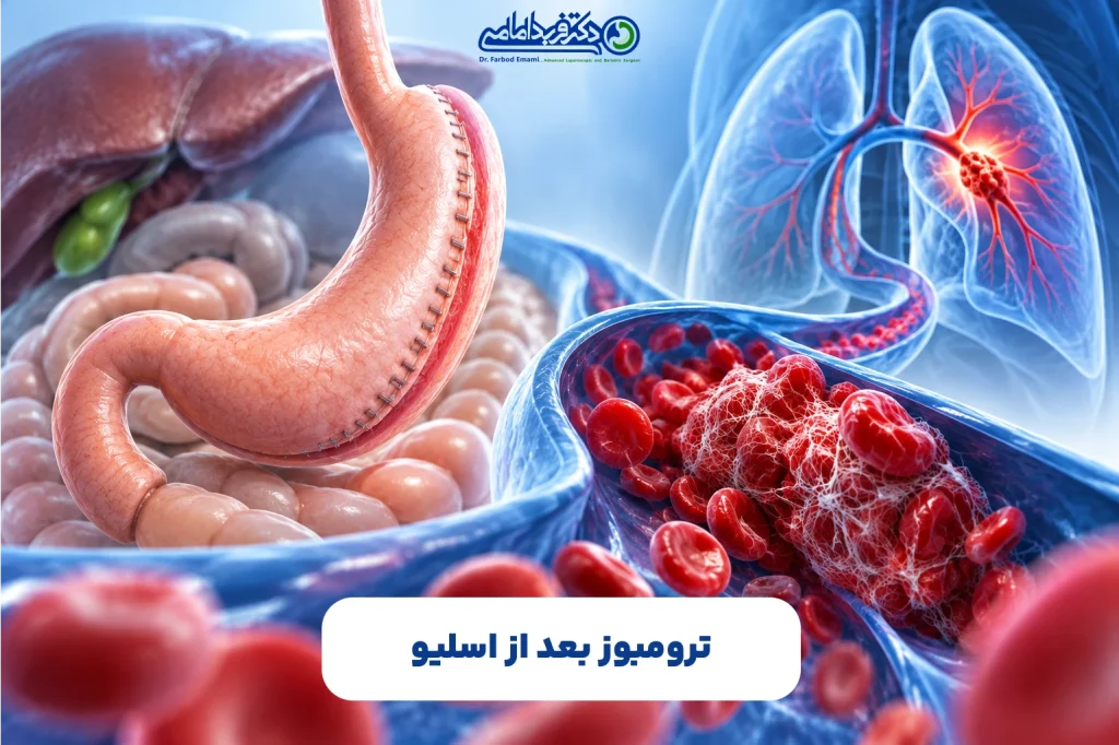 آیا آمبولی ریه فقط بعد از اسلیو اتفاق می‌افتد؟