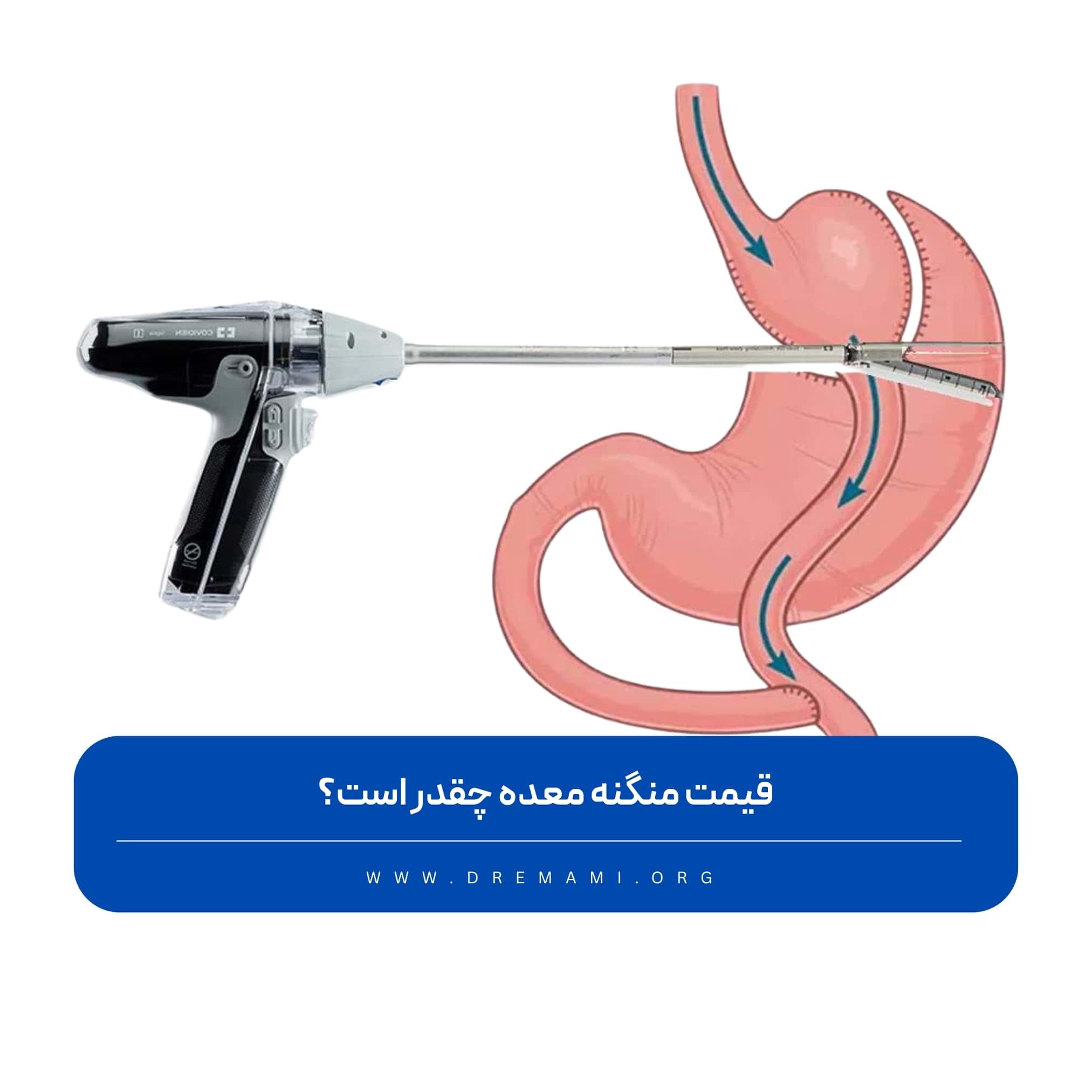قیمت منگه معده چقدر است؟