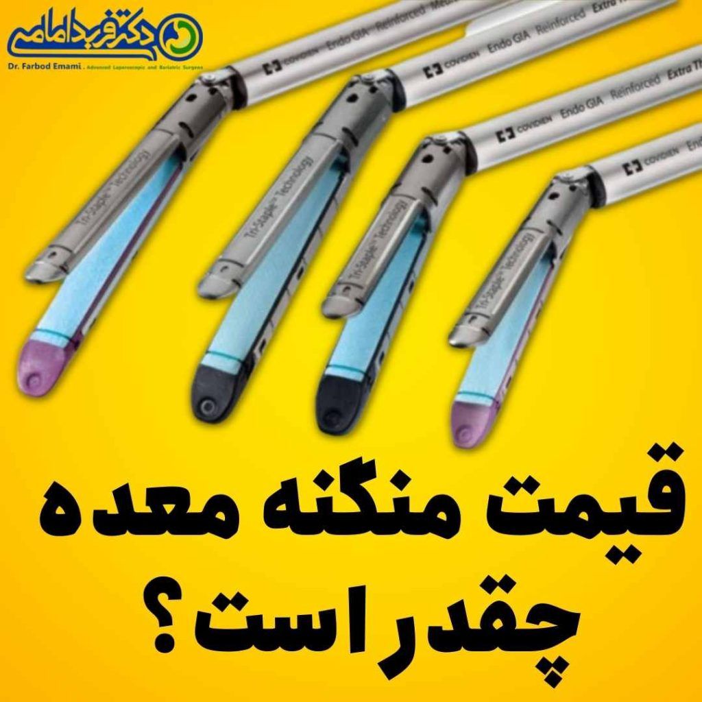 قیمت منگه معده چقدر است؟