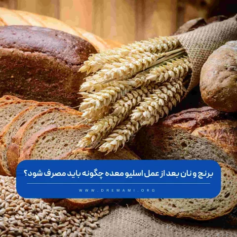 نان و برنج بعد از اسلیو معده