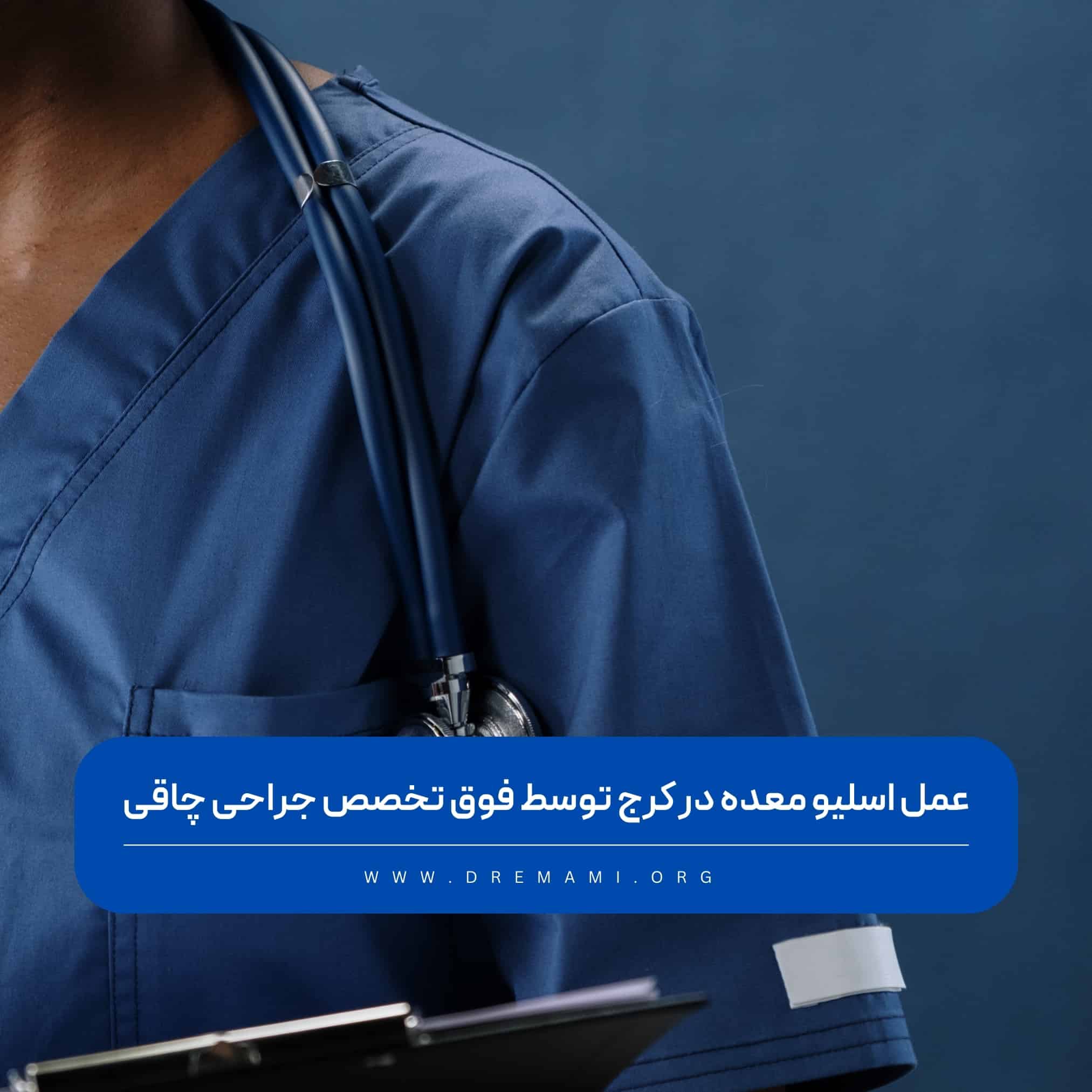 اسلیو معده در کرج