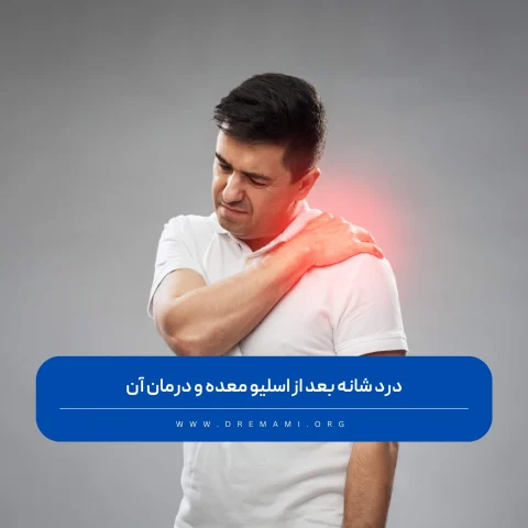 درد شانه بعد از اسلیو معده
