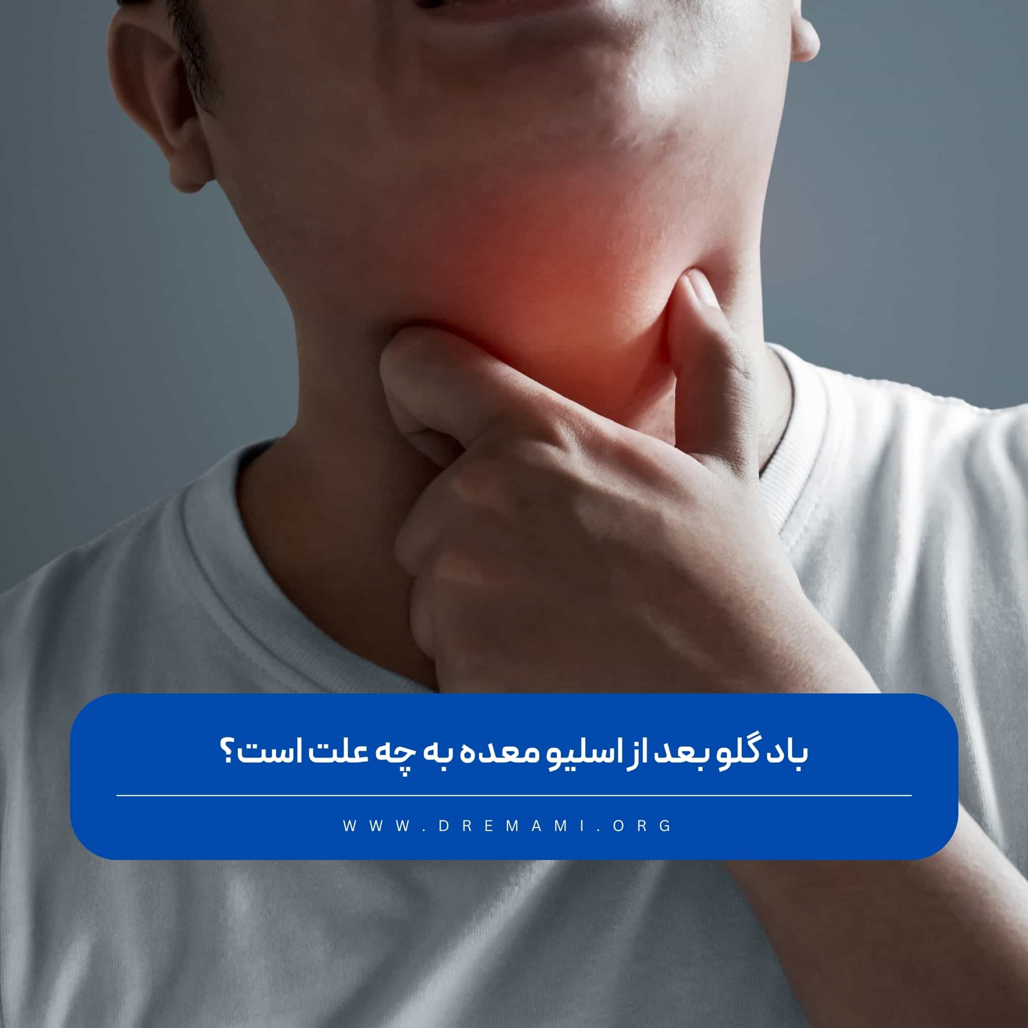 باد گلو بعد از اسلیو معده