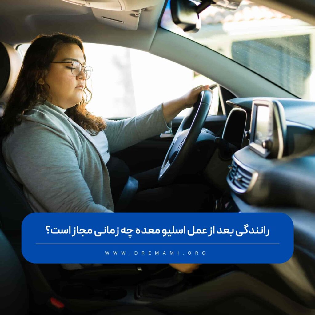 رانندگی بعد از اسلیو معده