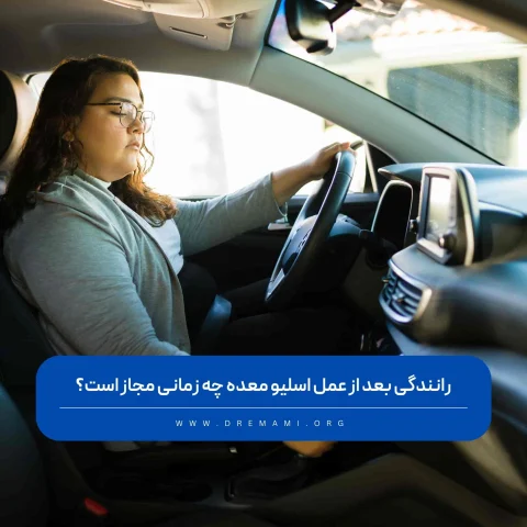 رانندگی بعد از اسلیو معده
