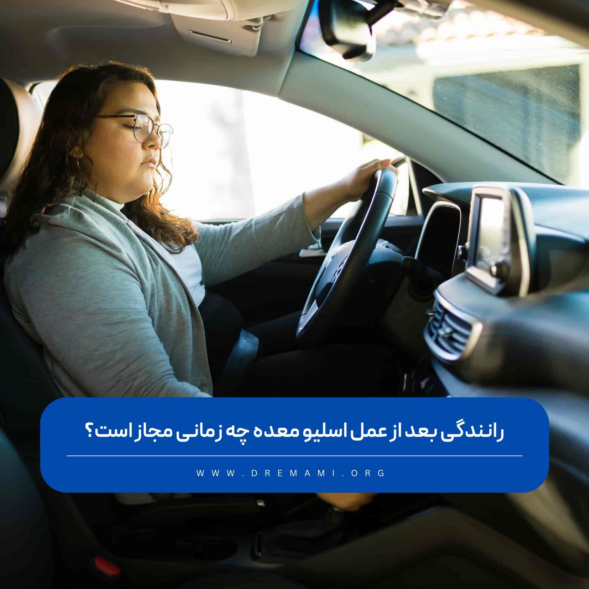 رانندگی بعد از اسلیو معده