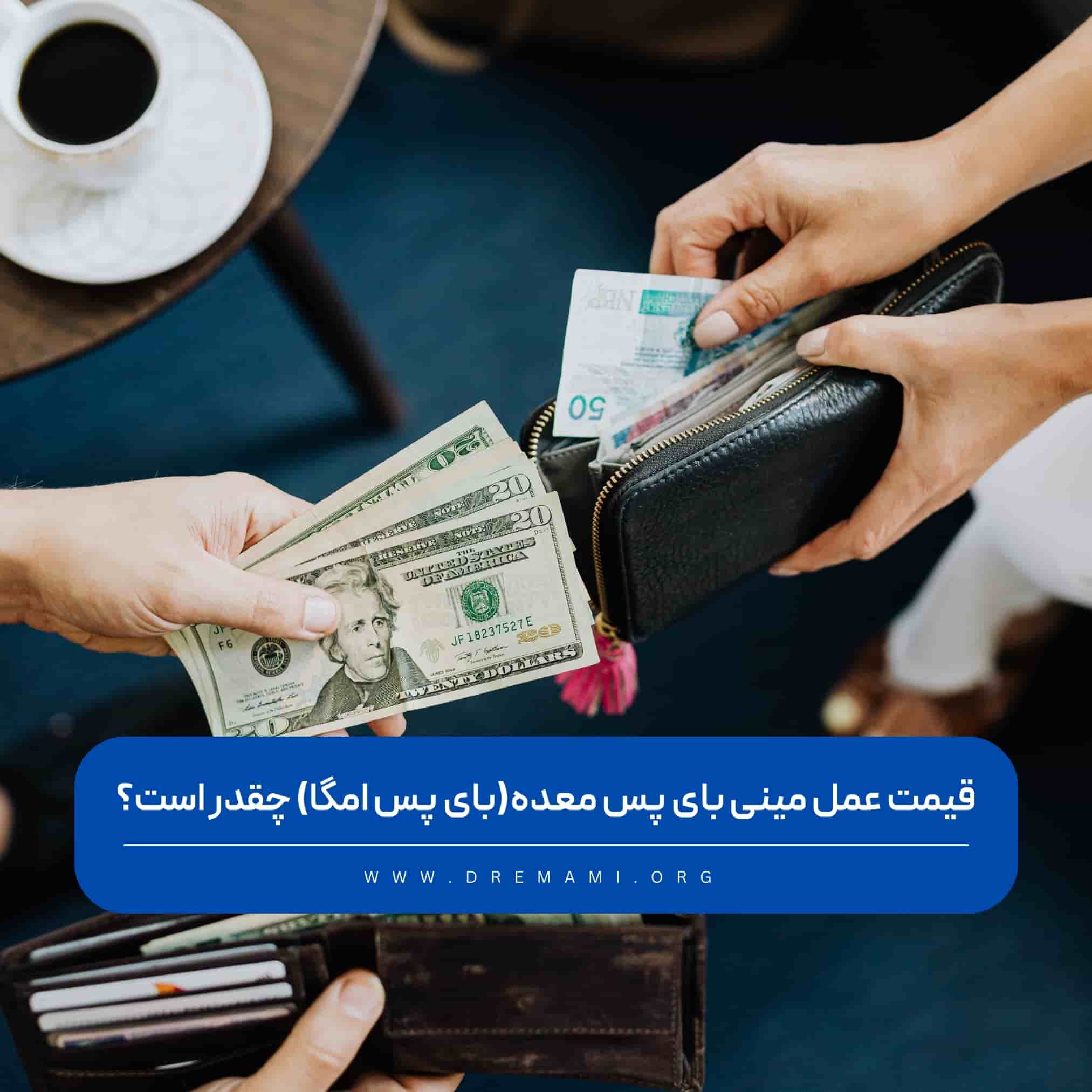 هزینه مینی بای پس معده