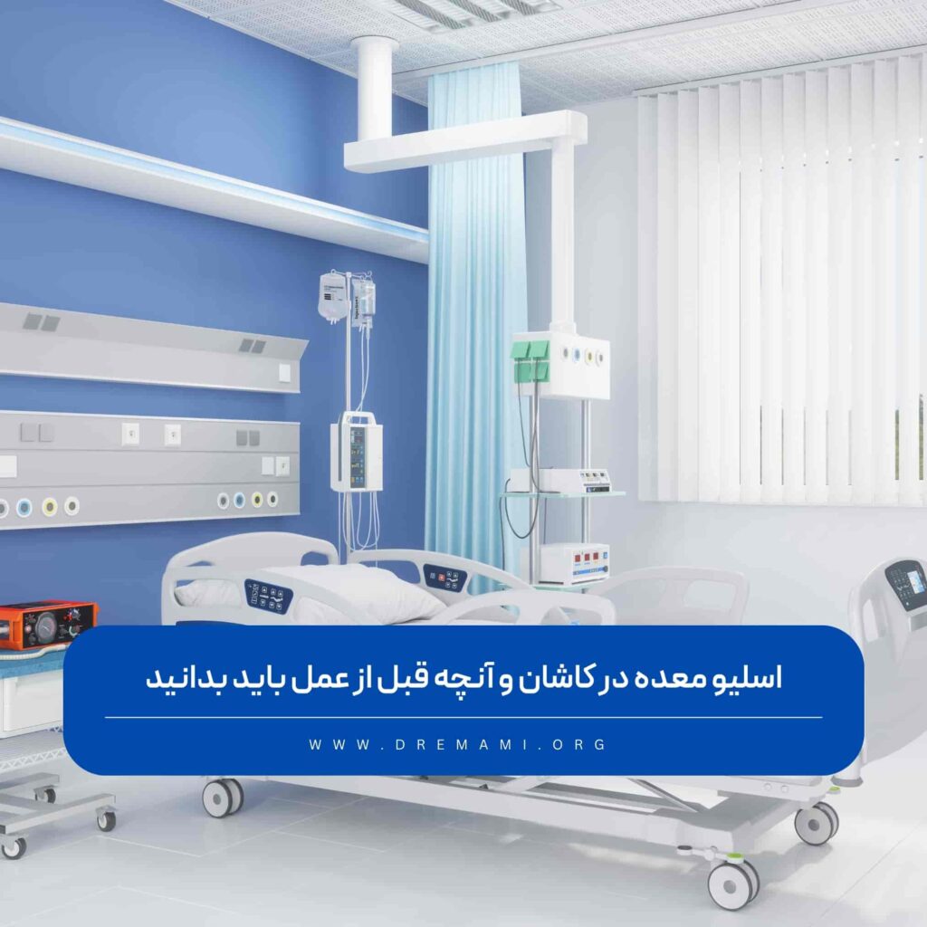 اسلیو معده در کاشان