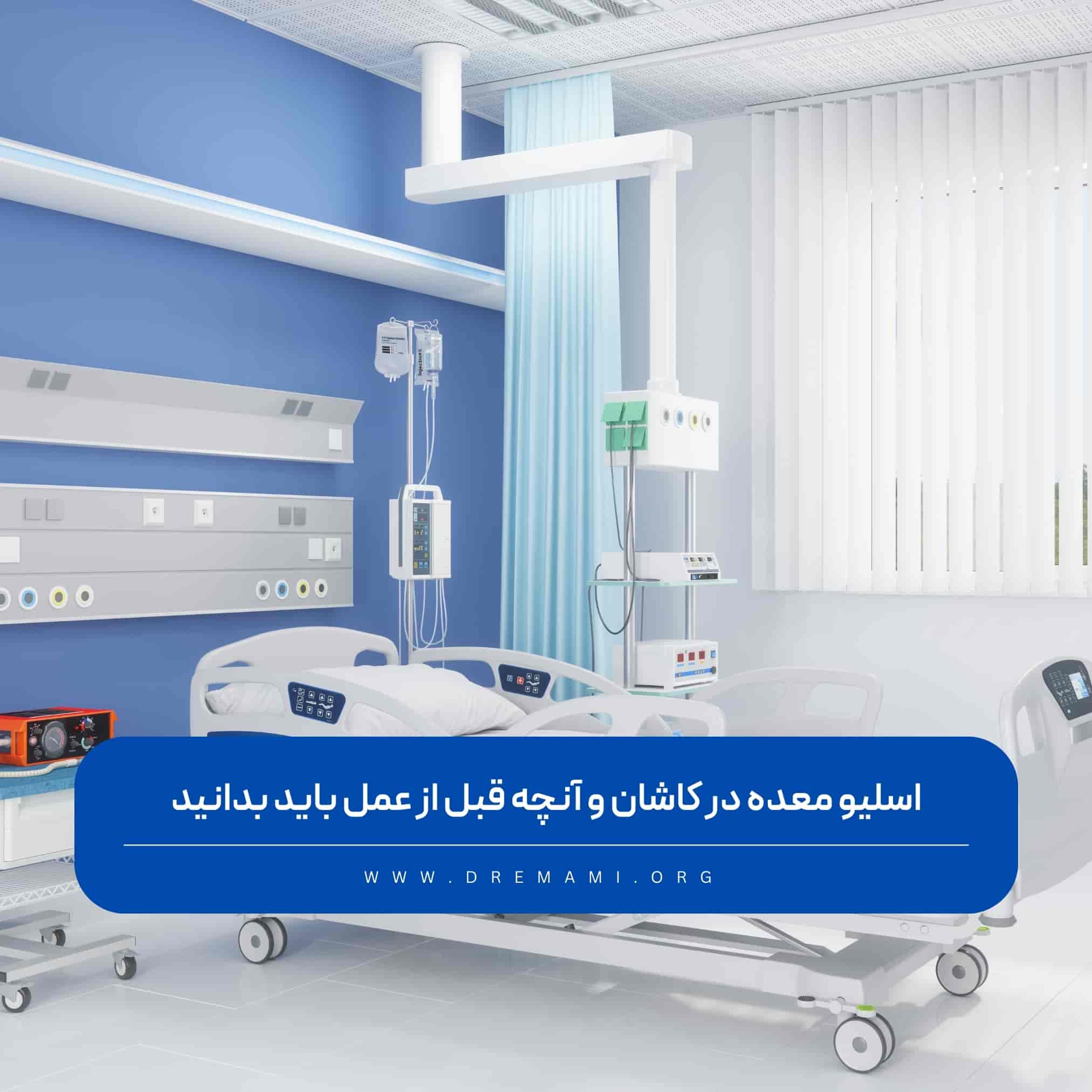 اسلیو معده در کاشان