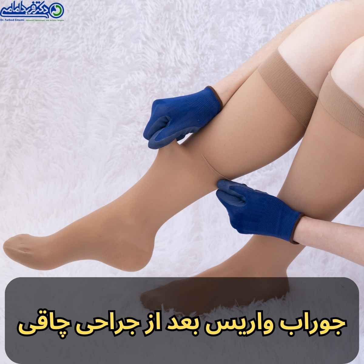 پوشیدن جوراب واریس بعد از جراحی