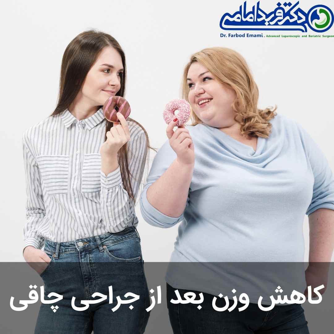 کاهش وزن بعد از جراحی چاقی