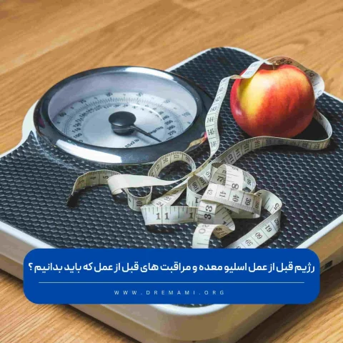 رژیم قبل از اسلیو معده
