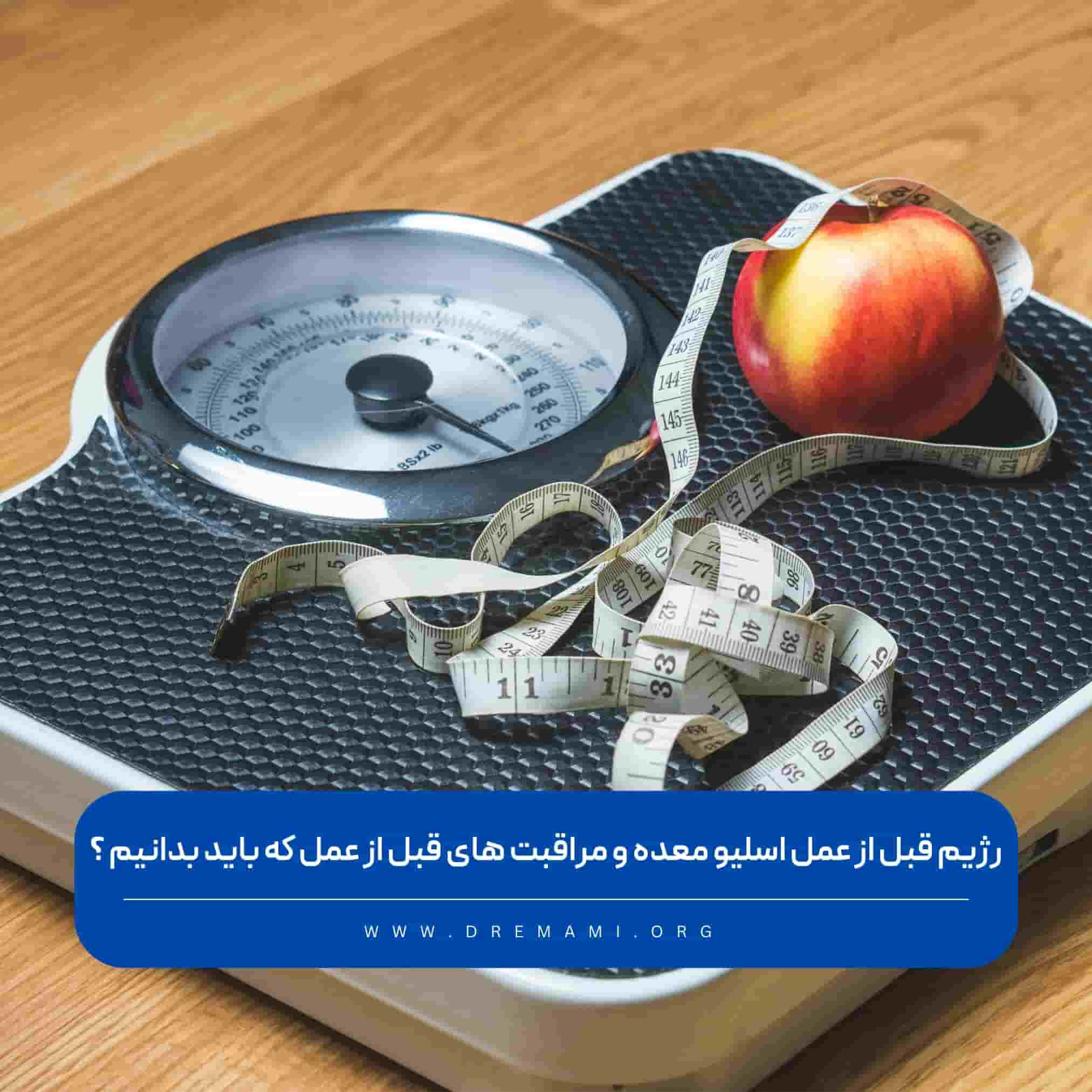 رژیم قبل از اسلیو معده