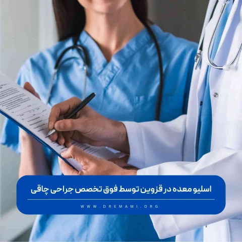 اسلیو معده در قزوین