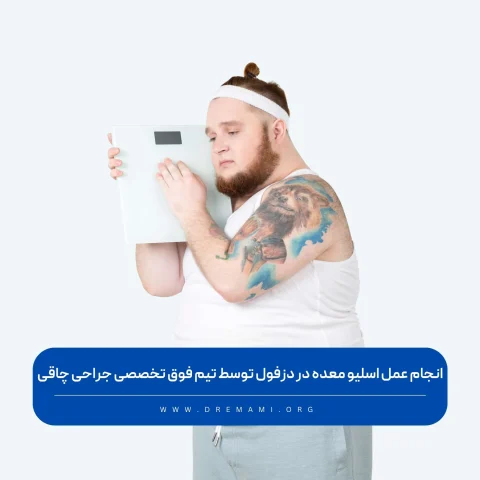 عمل اسلیو معده در دزفول