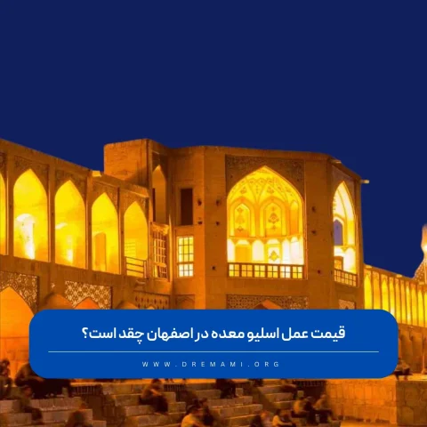 قیمت عمل اسلیو معده در اصفهان