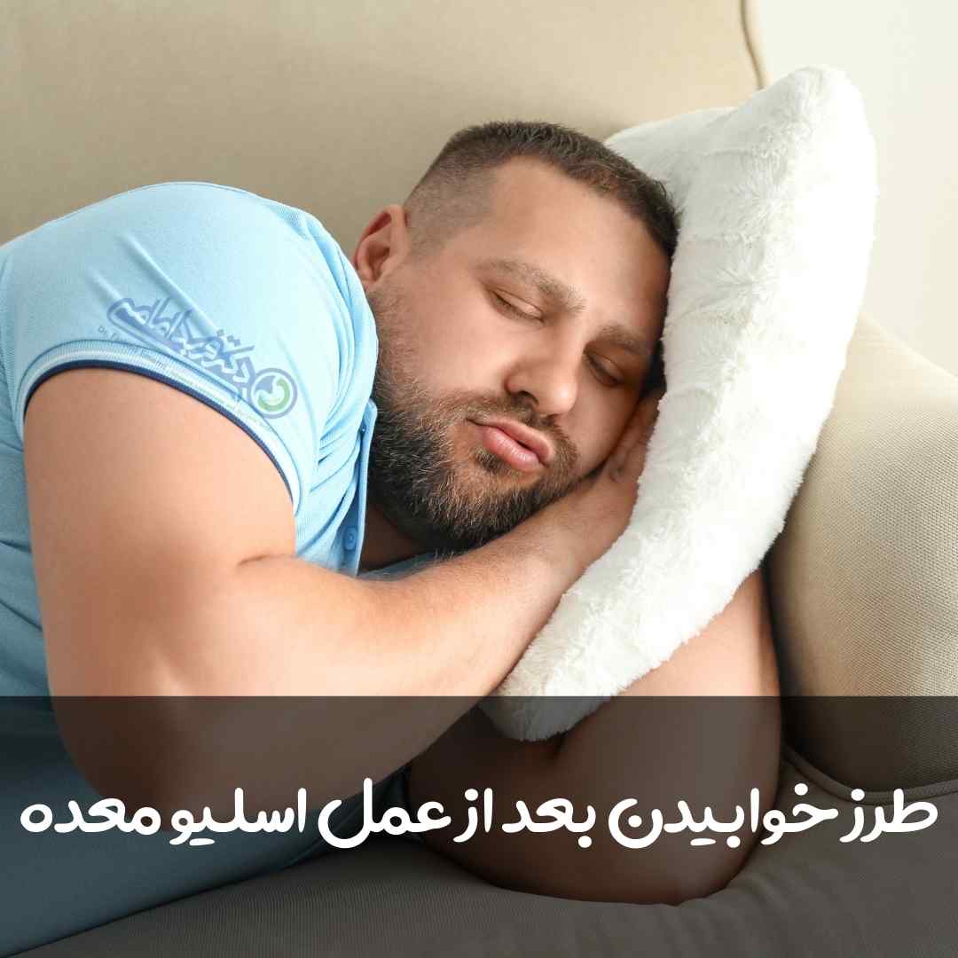 طرز خوابیدن بعد از عمل اسلیو معده