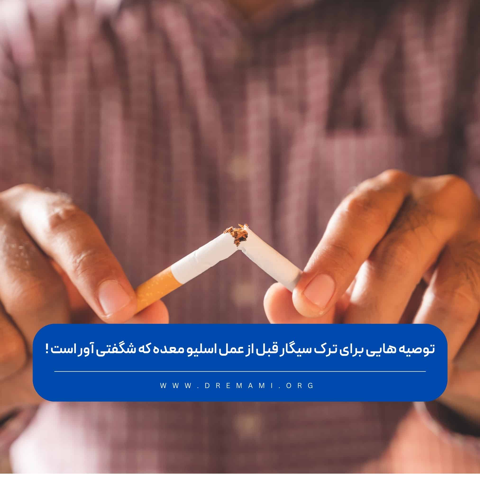 ترک سیگار قبل از عمل اسلیو معده
