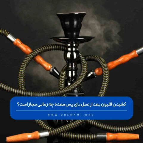 قلیون بعد از عمل بای پس معده