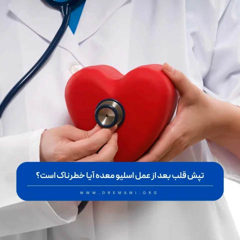 تپش قلب بعد از عمل اسلیو معده